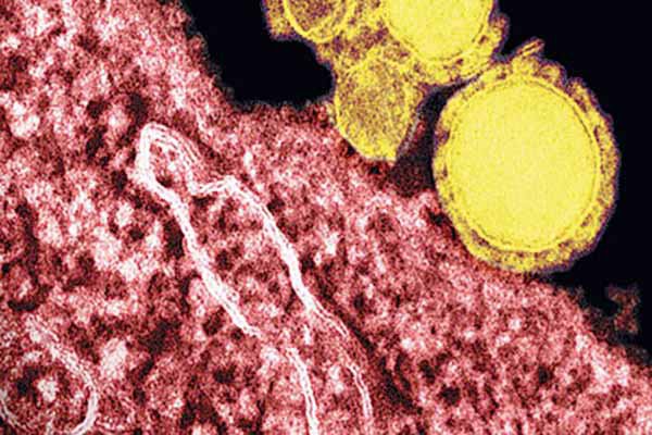 MERS virüsü nedir, nasıl bulaşır