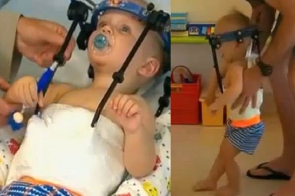 Başı kopan 16 aylık bebek hayata yeniden tutundu