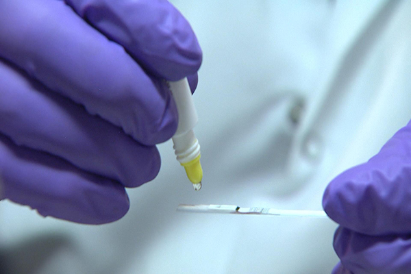 Ebola testi onaylandı
